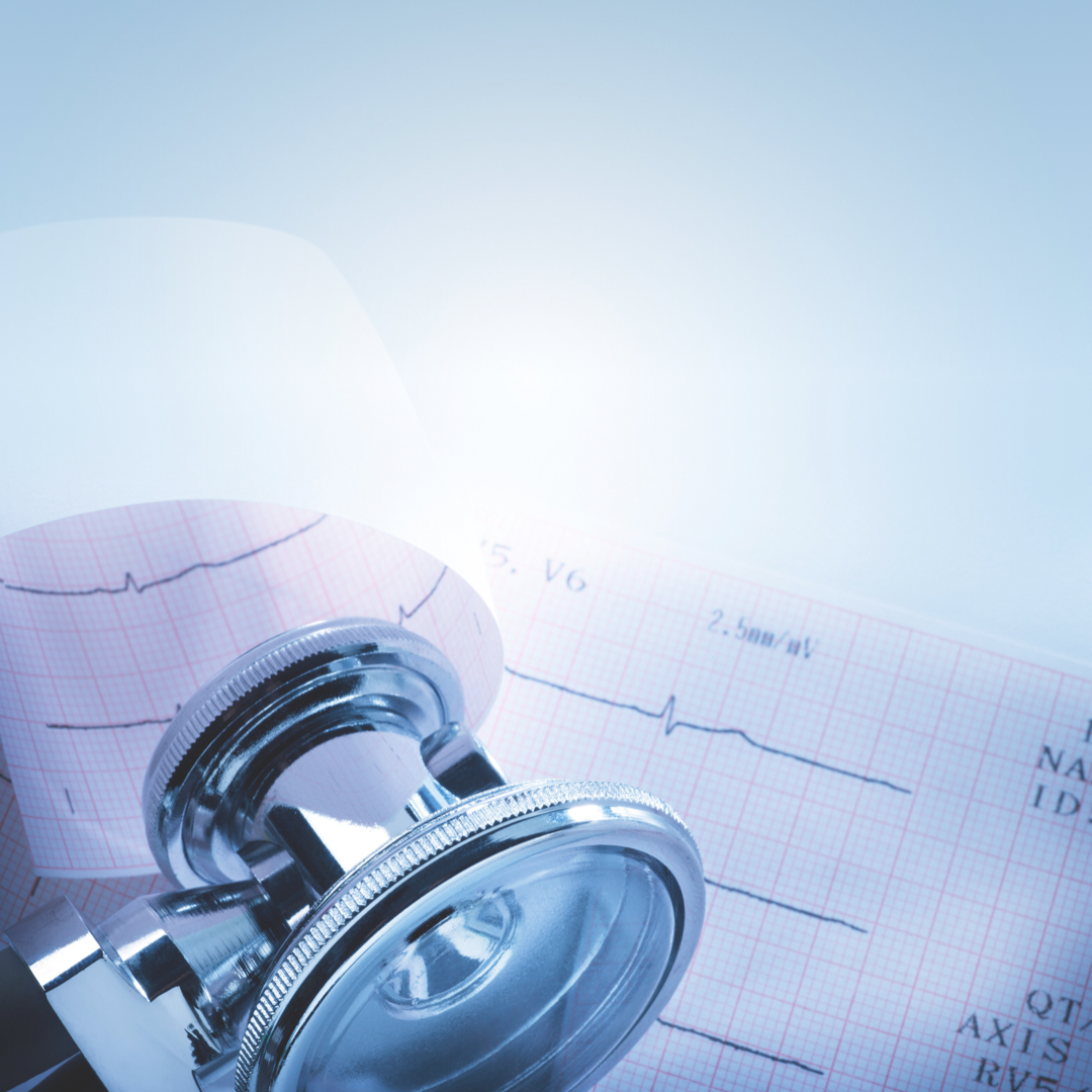 Ekg sin nombre